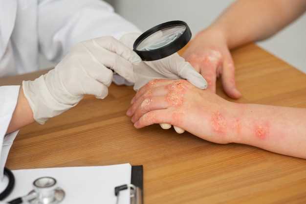 Famotidine Treatment for Warts